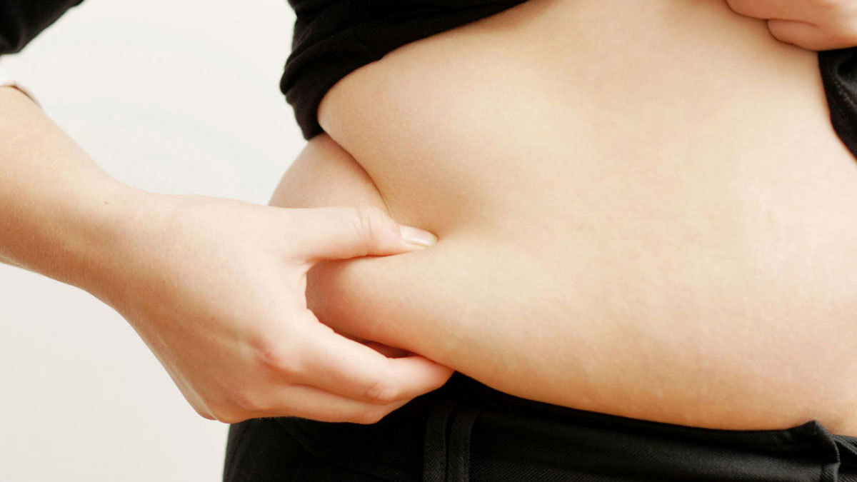 الكويت.. سيدة "بدون" أرادت "شفط الدهون" للحصول على جسد ناعم فحصلت على تشوهات