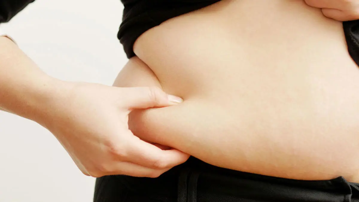 الكويت.. سيدة "بدون" أرادت "شفط الدهون" للحصول على جسد ناعم فحصلت على تشوهات