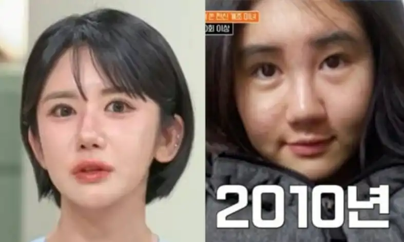 جيل لي-وون قبل وبعد