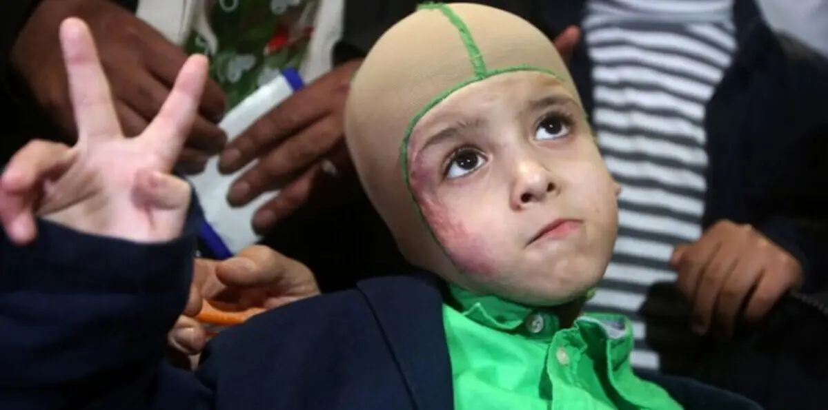 إحراق منزل الشاهد الوحيد على حادثة حرق عائلة الدوابشة 