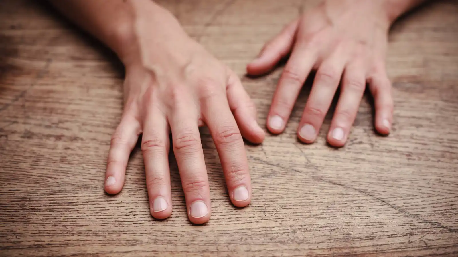 "الزرقة الطرفية".. لماذا تتحول يداك إلى اللون الأزرق؟