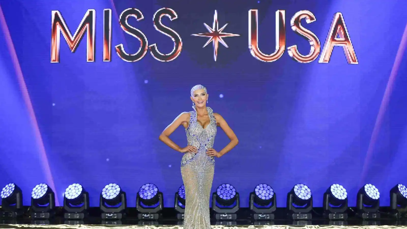 "ملكة جمال" تواجه الثعلبة وتظهر دون شعر مستعار (صور)