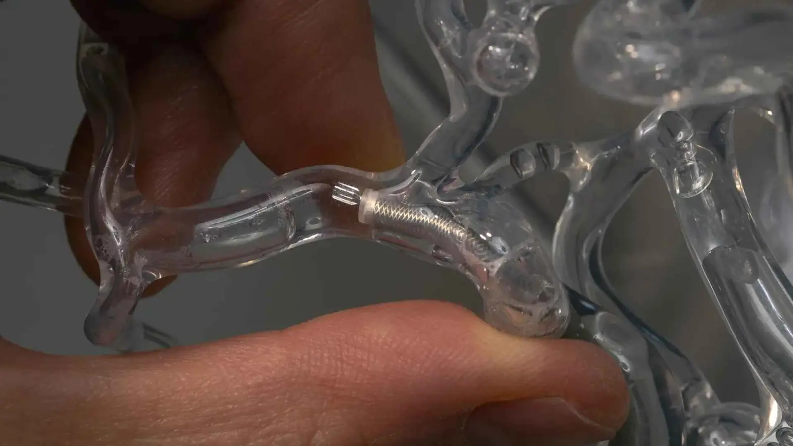 بحجم عود ثقاب.. ابتكار ثوري لإزالة الجلطات دون جراحة