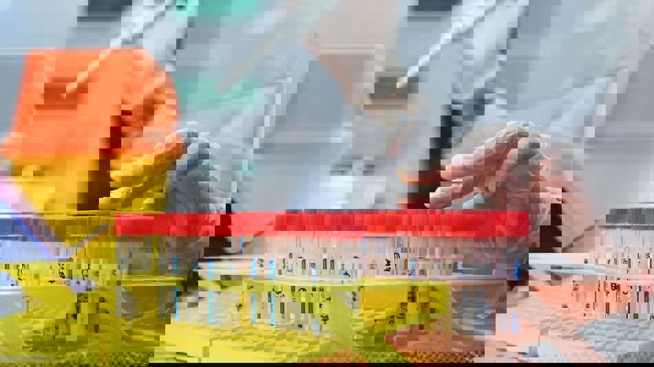 "الصحة العالمية" تدرس تقارير عن اكتشاف جدري القرود في مني المصابين