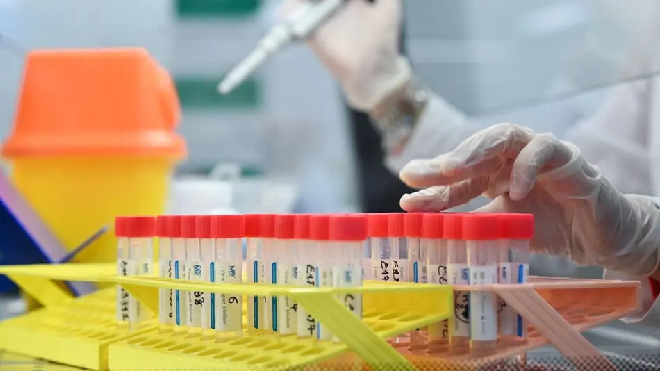 "الصحة العالمية" تدرس تقارير عن اكتشاف جدري القرود في مني المصابين