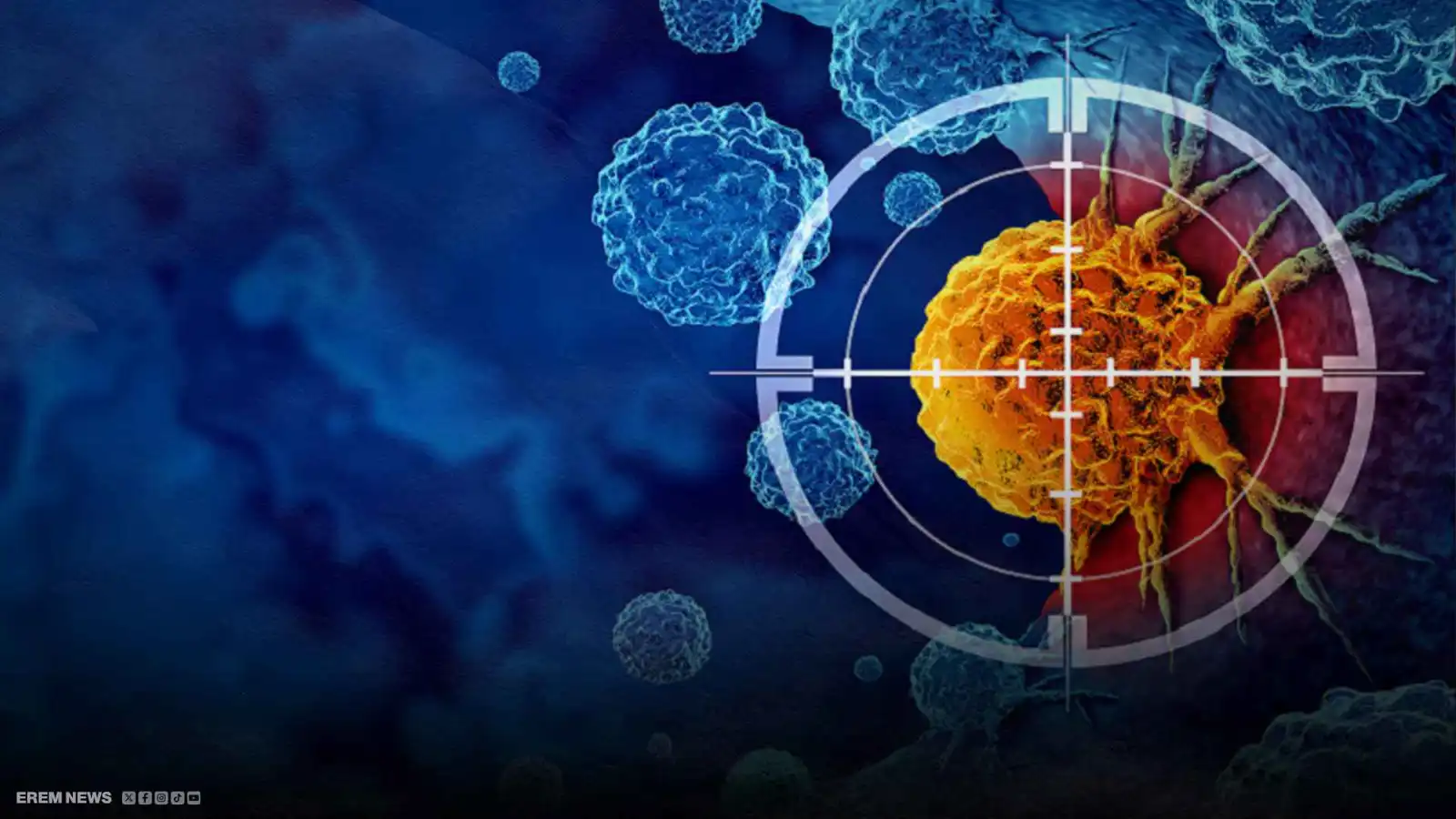 قبل الورم بخطوة.. اختراق علمي يرصد إشارات السرطان الأولى (فيديو إرم)