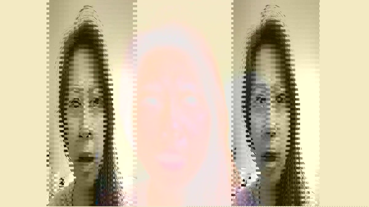 بعد جراحة في اللوزتين.. أسترالية تتغير لهجتها إلى الأيرلندية