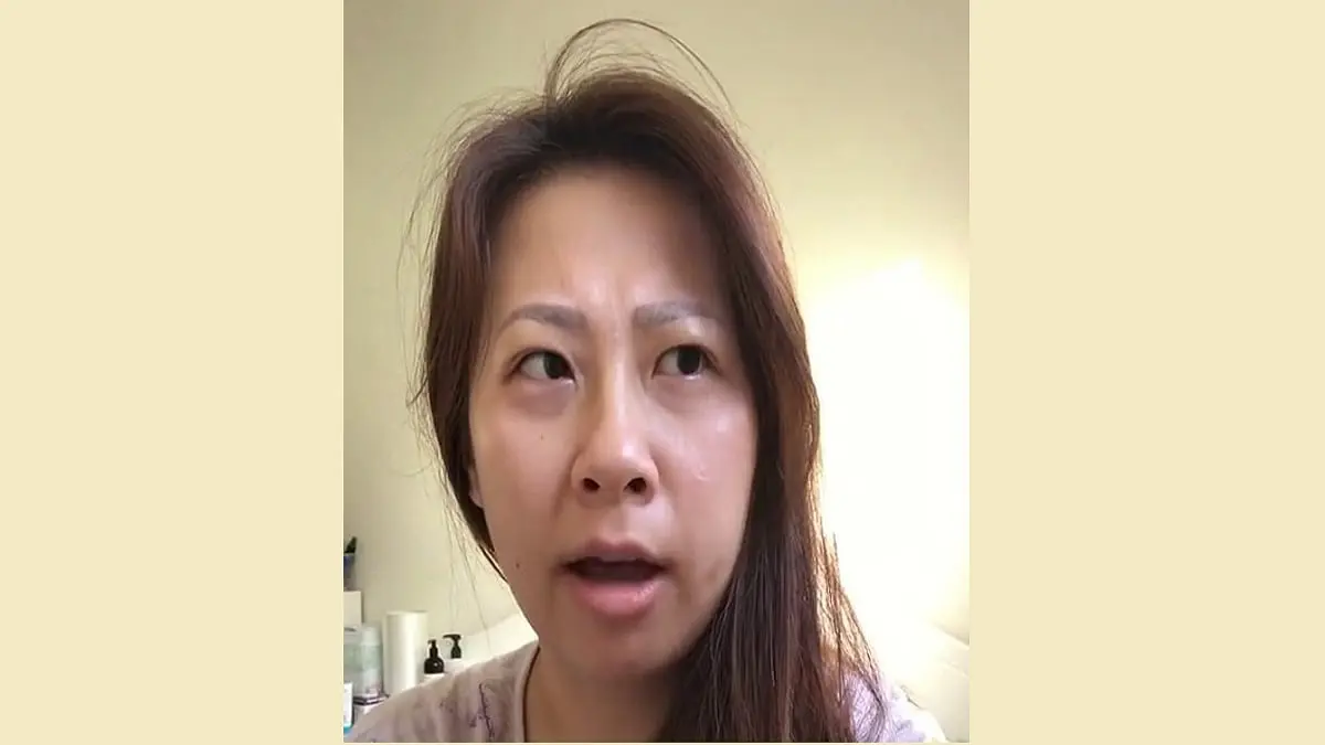 بعد جراحة في اللوزتين.. أسترالية تتغير لهجتها إلى الأيرلندية