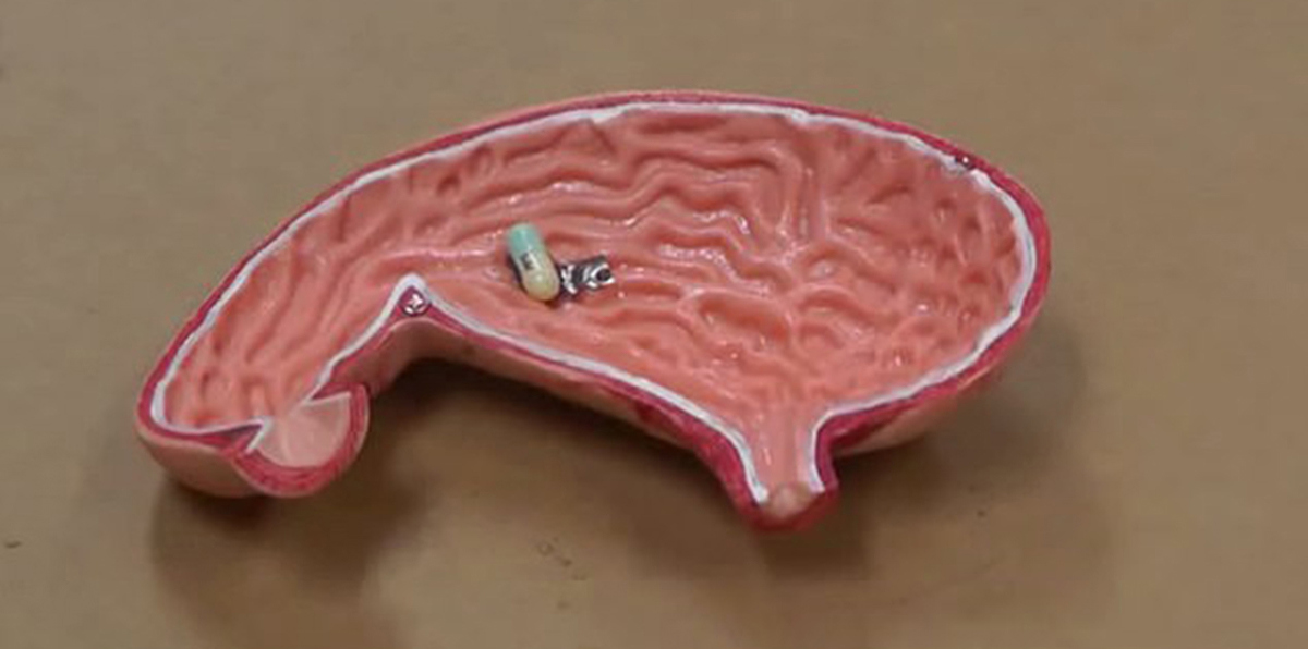 بالفيديو.. ابتكار روبوت دقيق يزحف داخل الجسم لإيصال الأدوية