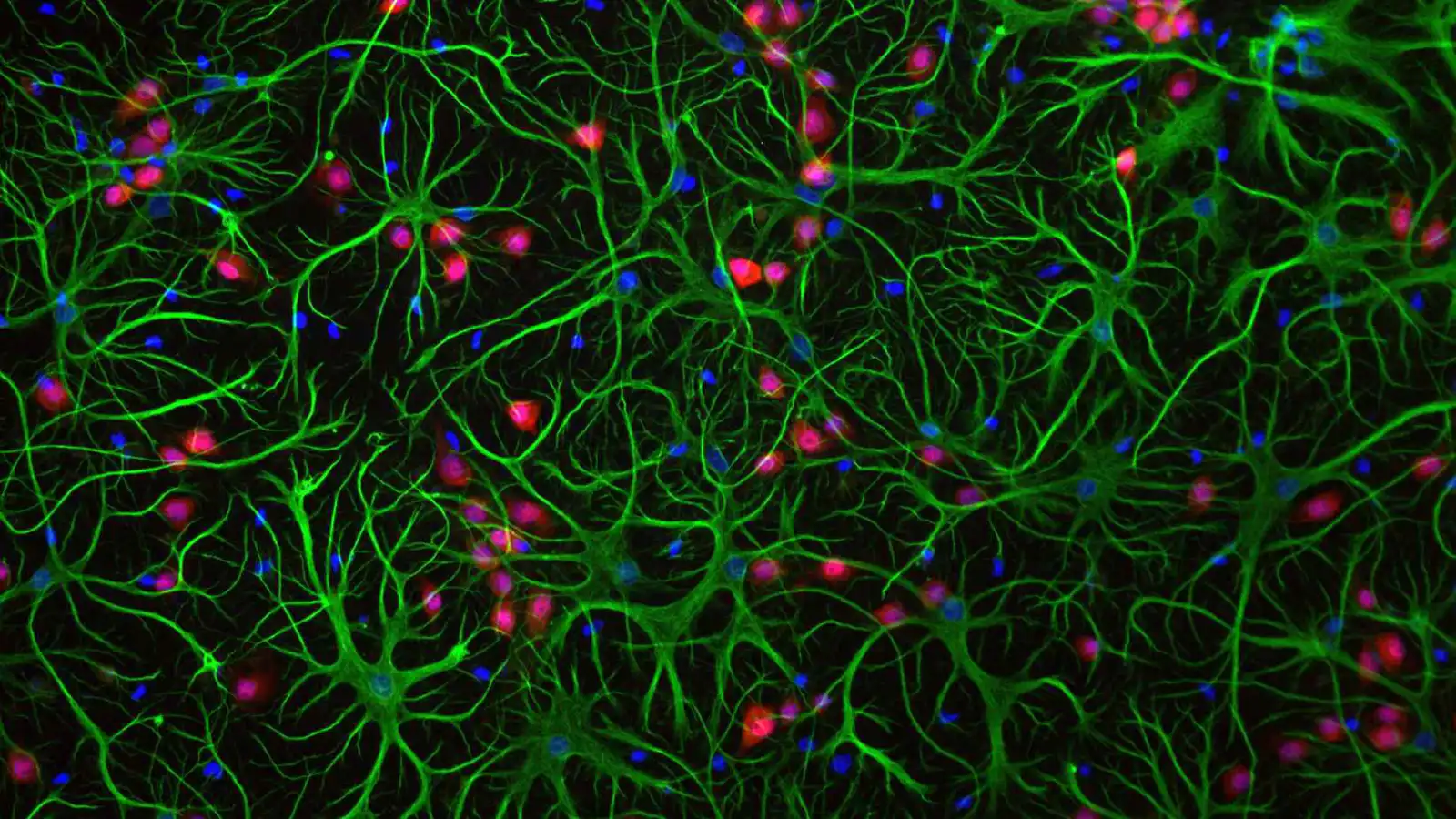 هل تحمل هذه الخلايا "المنسية" في الدماغ سر علاج الاكتئاب؟