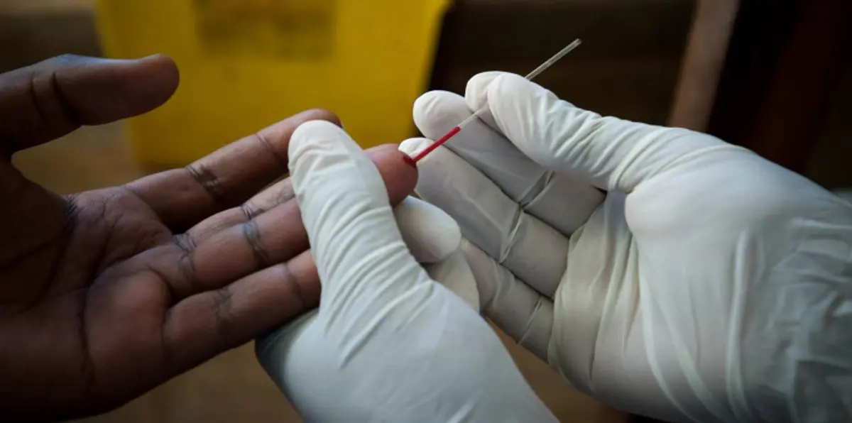 العلماء يعثرون على علاج فعال للقضاء على الفيروس المسبب للإيدز