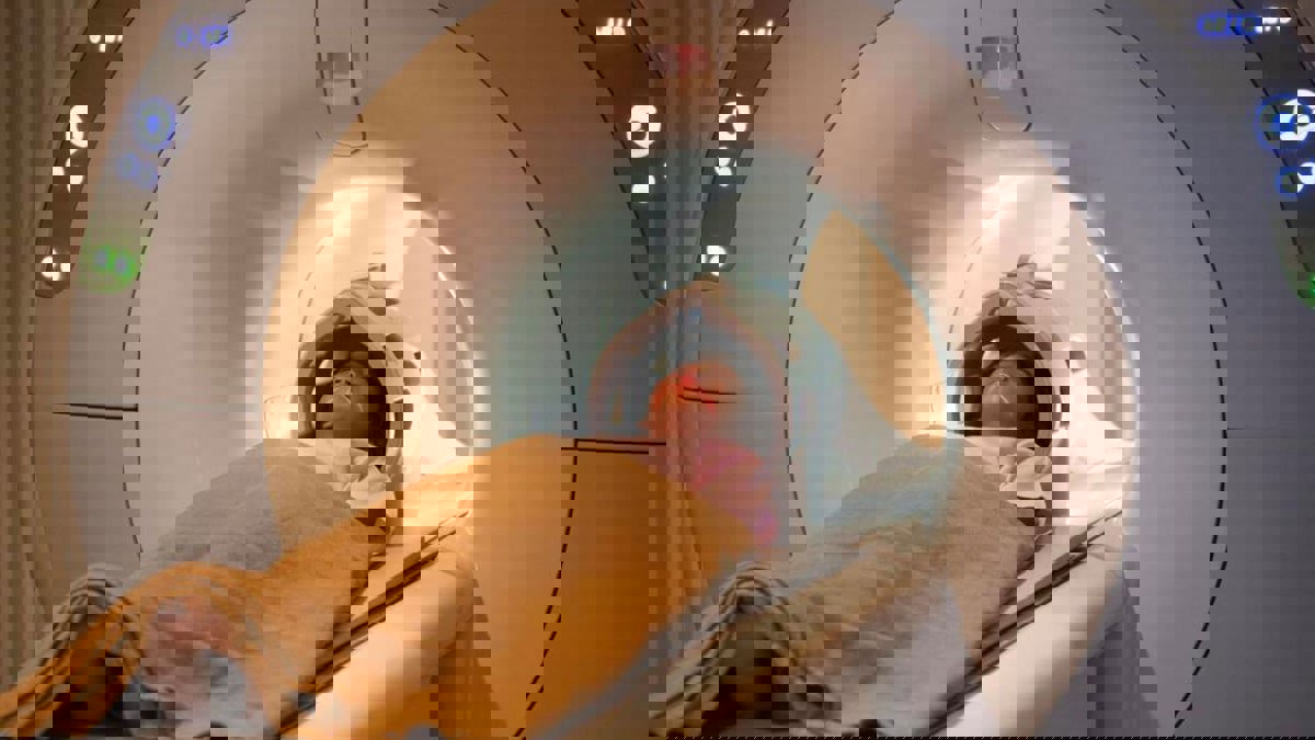 دراسة تؤكد أهمية فحص الرنين المغناطيسي لكشف سرطان البروستات