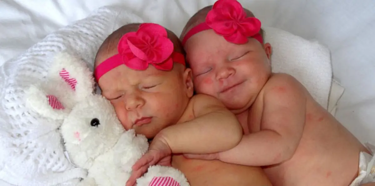 امرأة تلد توأماً من رجلين مختلفين