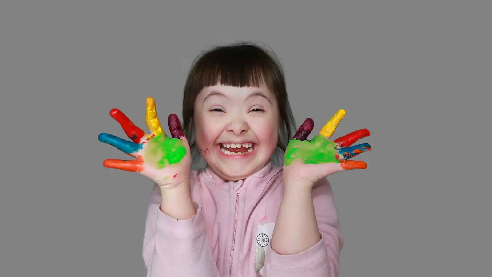 إنجاز علمي يفتح آفاقا لعلاج متلازمة داون عبر تقنية تحرير الجينات