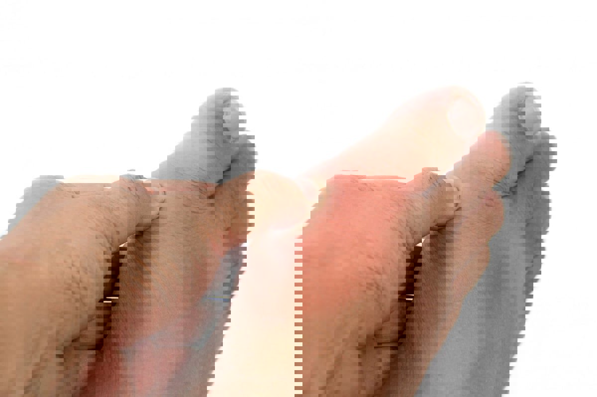 النقرس يحد من مخاطر مرض الزهايمر‎