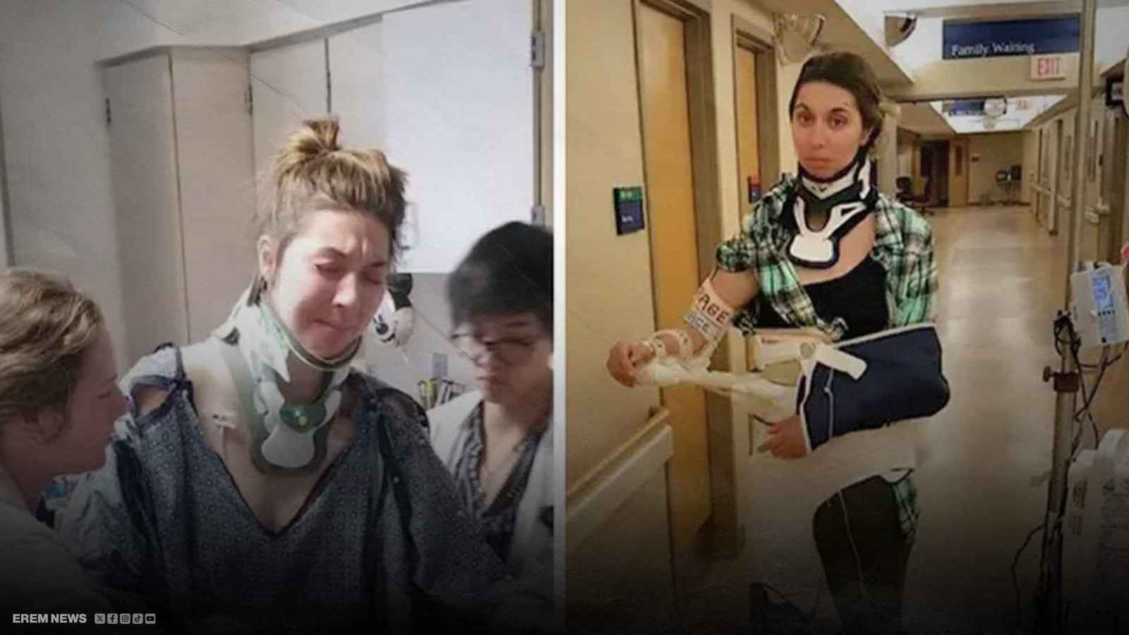 "تمثال حي".. شابة تبهر الأطباء بعد 37 عملية جراحية (فيديو إرم)