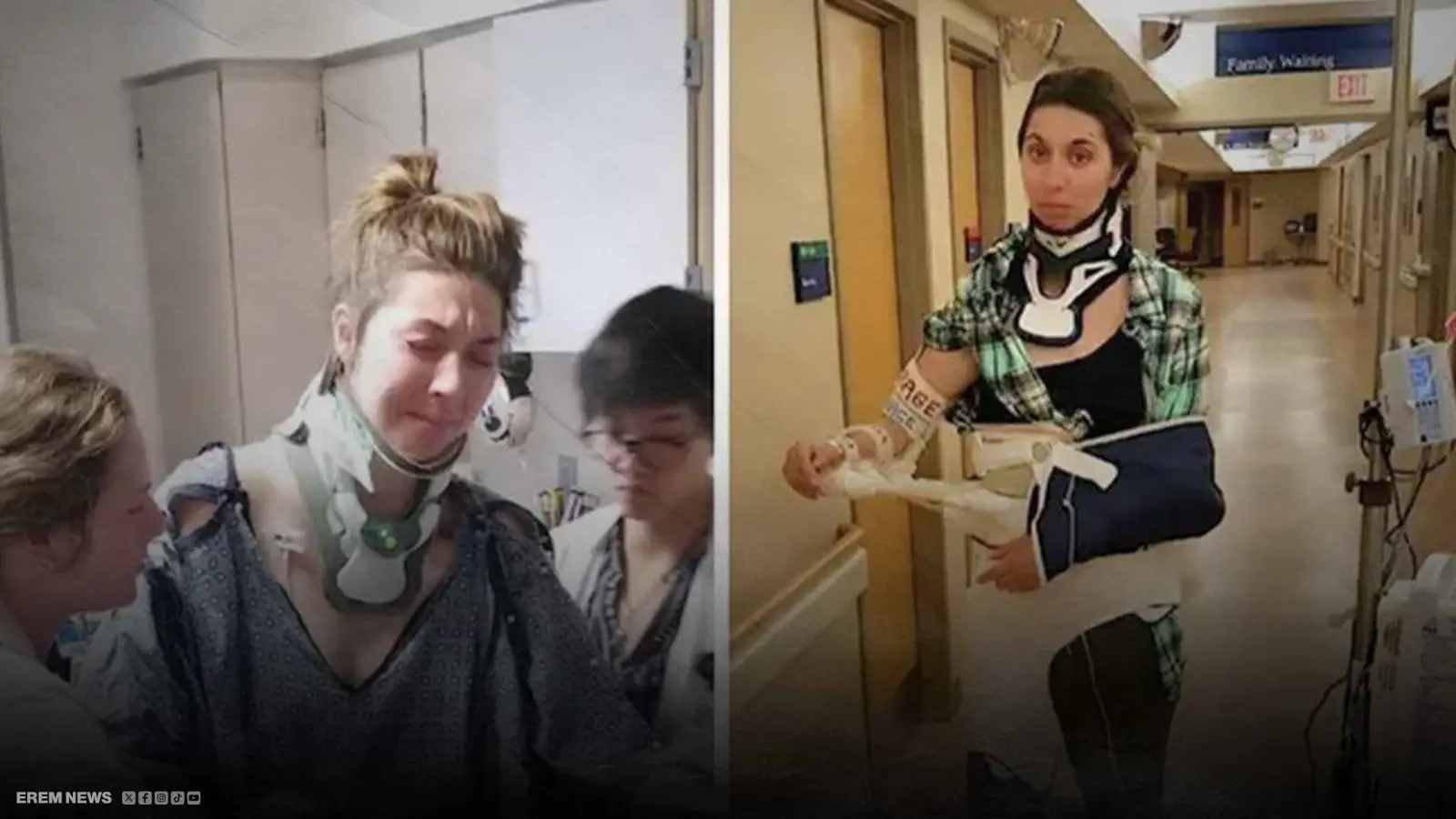 "تمثال حي".. شابة تبهر الأطباء بعد 37 عملية جراحية (فيديو إرم)