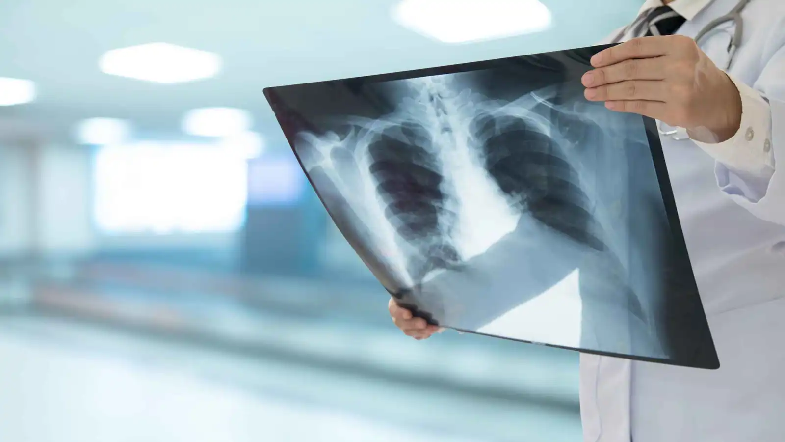 من الغذاء إلى الورم.. كيف يغذي السكر سرطان الرئة؟