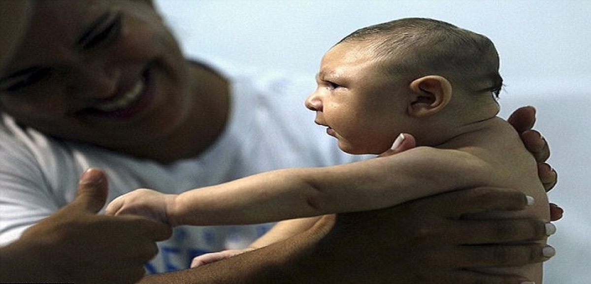 إسبانيا.. أول حالة تلف دماغي ناتج عن فيروس زيكا