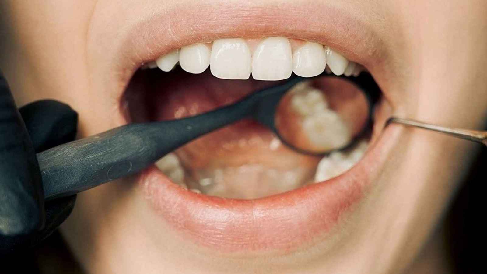 دراسة: بكتيريا الفم تحمي من التدهور الإدراكي للدماغ