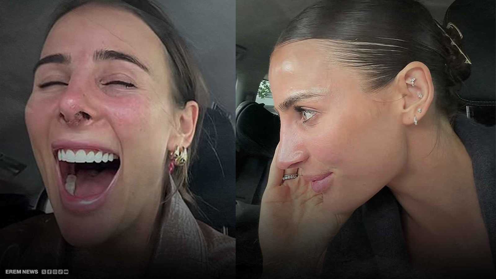 اشتراك مدفوع لمشاهدة أنفها.. مؤثرة أسترالية تثير الجدل (فيديو إرم)