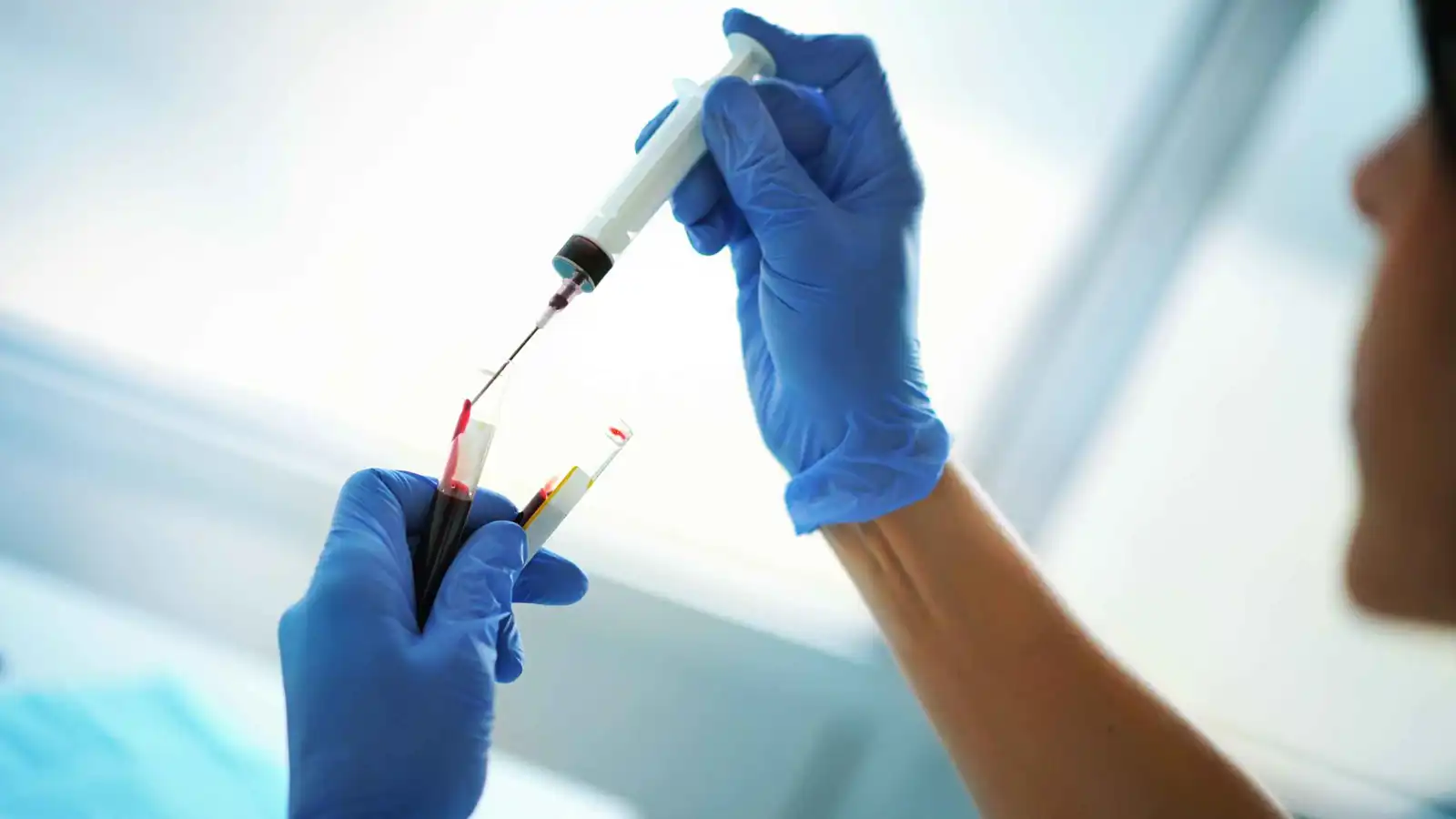 دراسة تكشف العلاقة بين فصيلة الدم والسكري