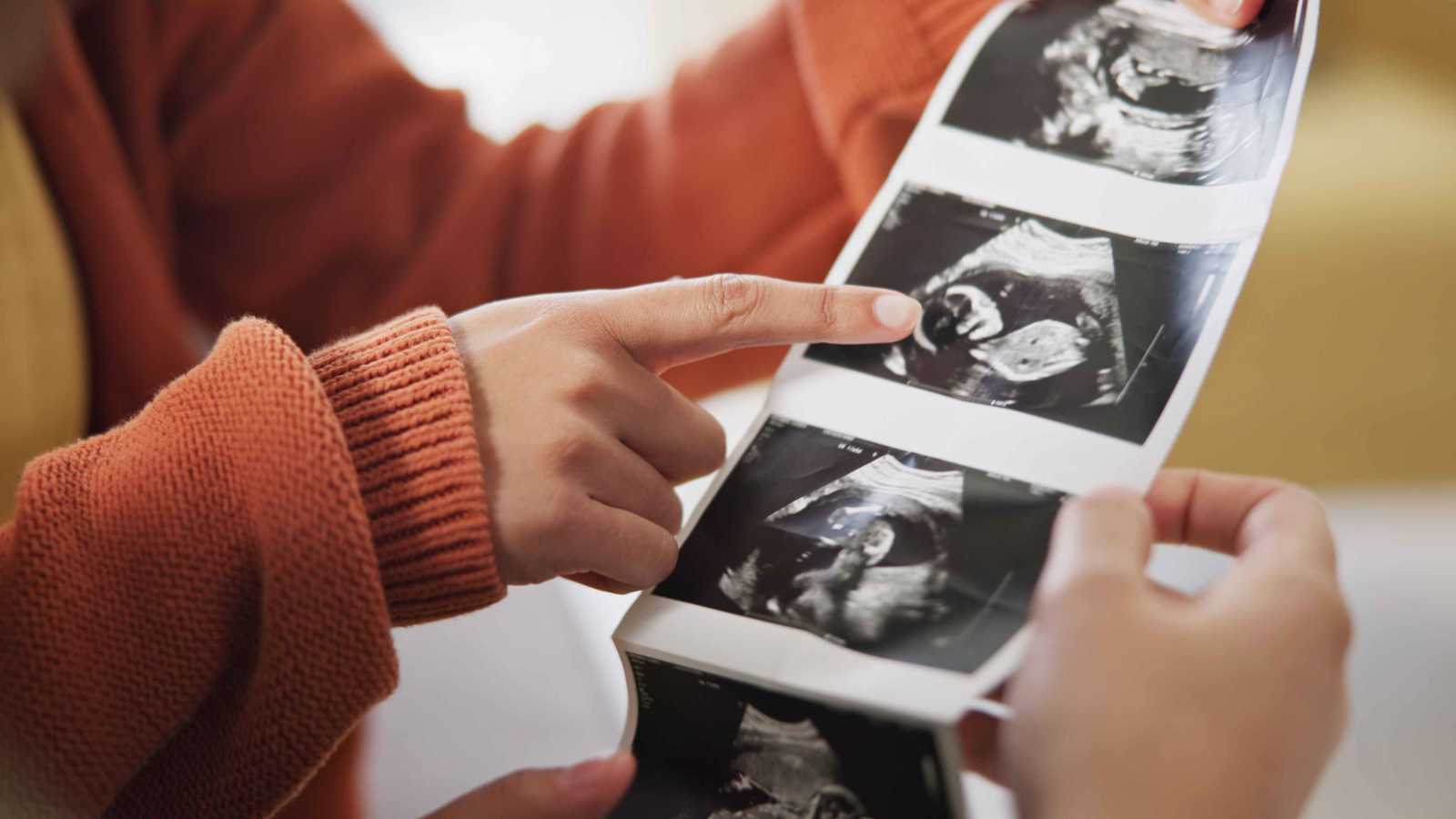 دراسة صادمة.. احتمال إنجاب ذكر أو أنثى ليس 50/50