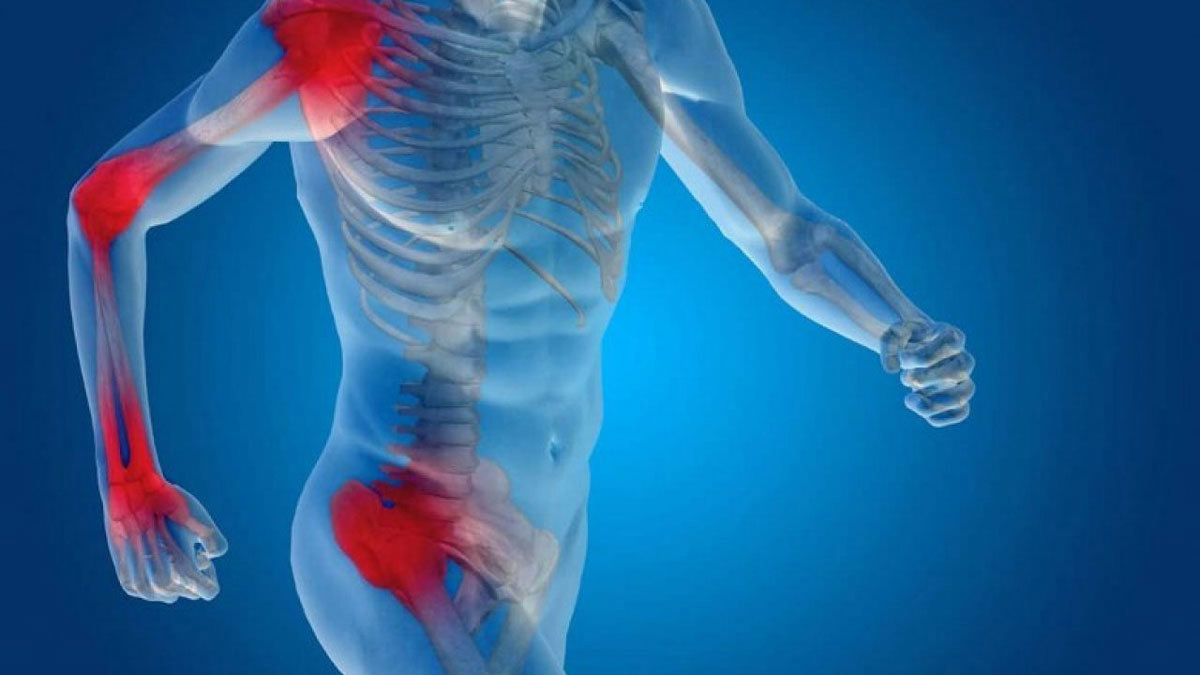 منها الزنجبيل والشاي الأخضر.. تعرف على علاجات طبيعية للسيطرة على آلام التهاب المفاصل وهشاشة العظام