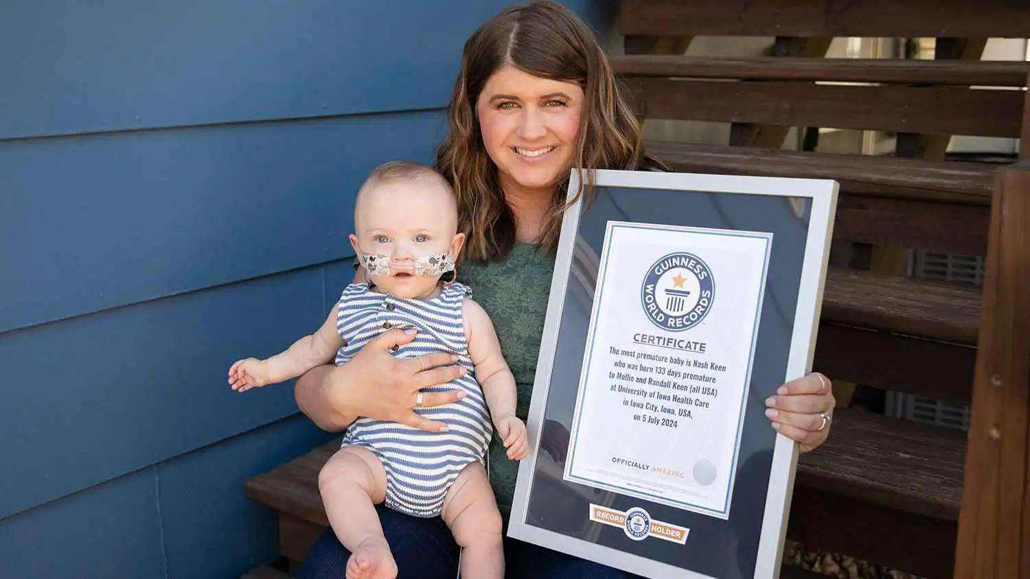 وُلد بحجم قطعة صابون.. أصغر طفل مبتسر في العالم يحتفل بعامه الأول (صورة)