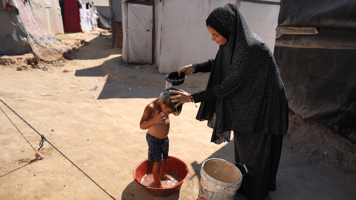 أمراض جلدية وأوبئة قاتلة.. مصير محفوف بالمخاطر للغزيين في مخيمات النزوح