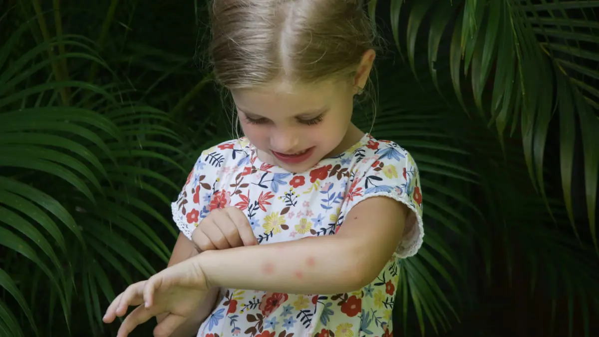 إنتان الدم.. أعراض لا يجب تجاهلها