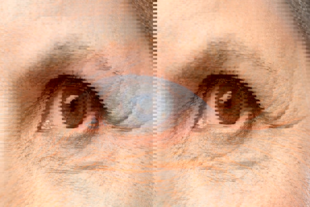 هكذا تظهر تجاعيد البشرة مع تقدم السن