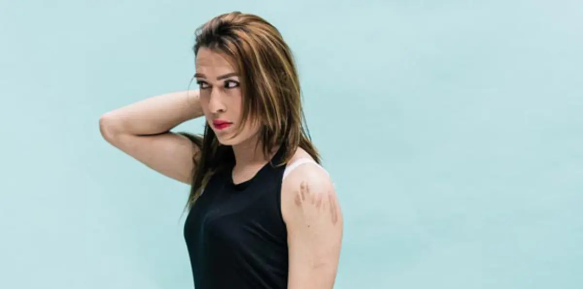 التحول الجنسي ظاهرة تربك محاكم دمشق وفقهاءها