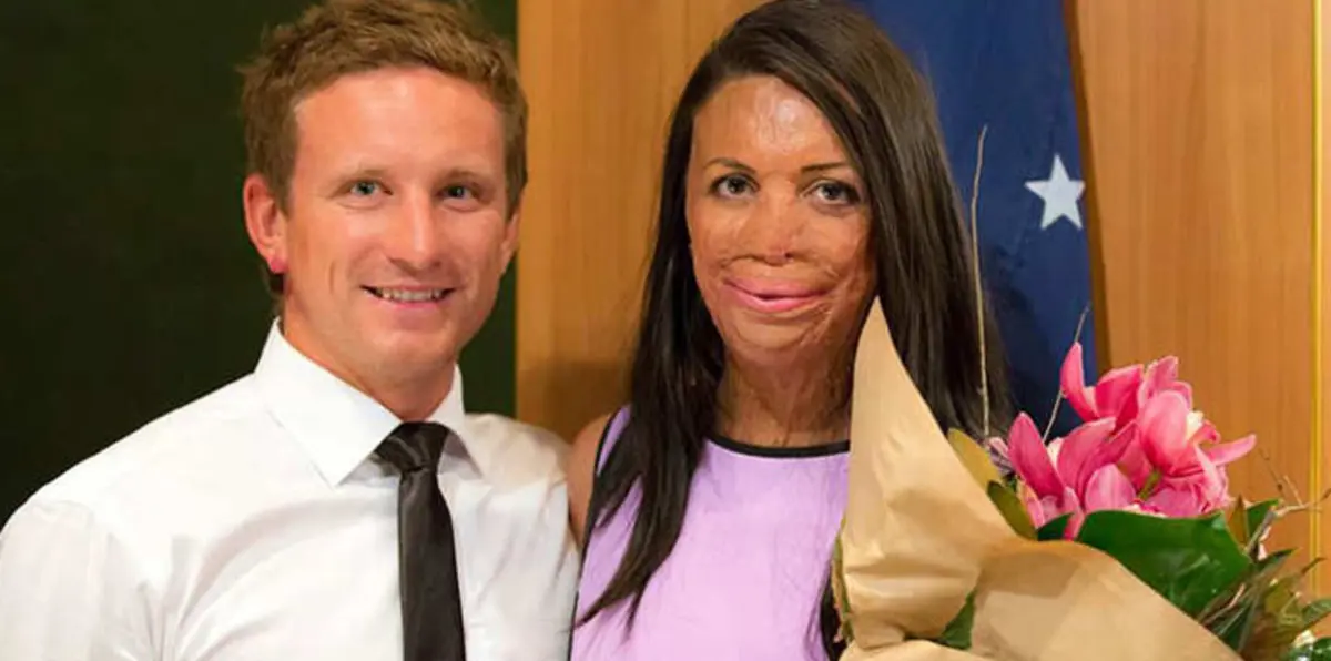 قصة حب نادرة تشعل وسائل التواصل الاجتماعي (صور)