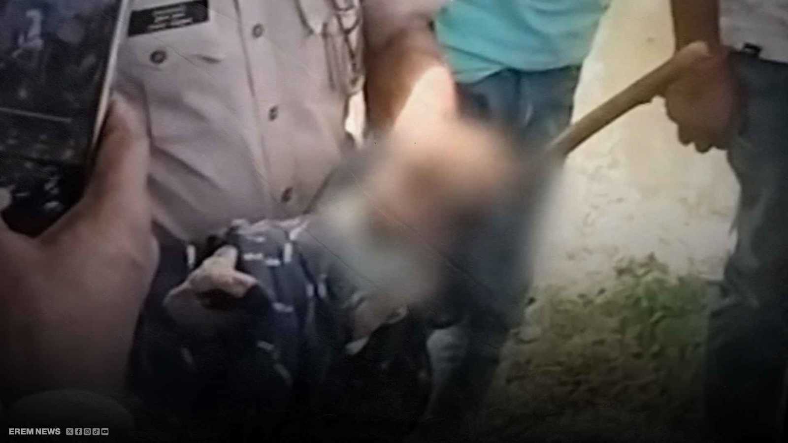 معجزة تنقذ حياة طفلة