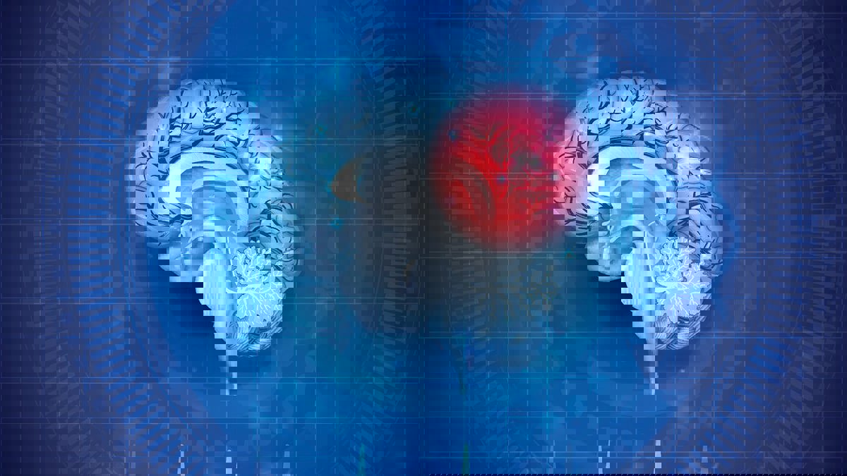 دراسة: النظام الغذائي أفضل من الجراحة لمنع السكتة الدماغية