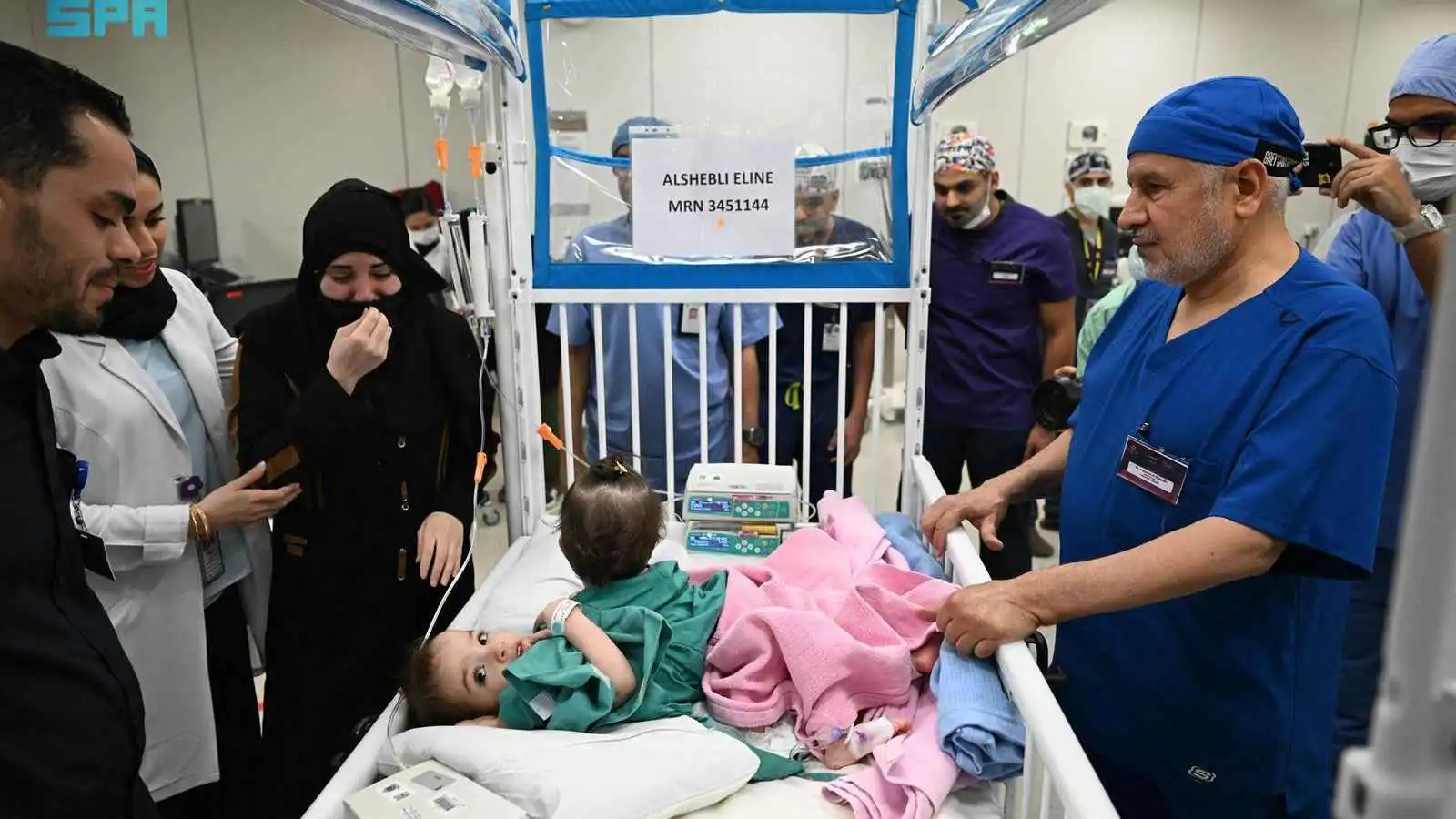 نجاح عملية فصل التوأم السوري "سيلين وإيلين" في الرياض (صور)