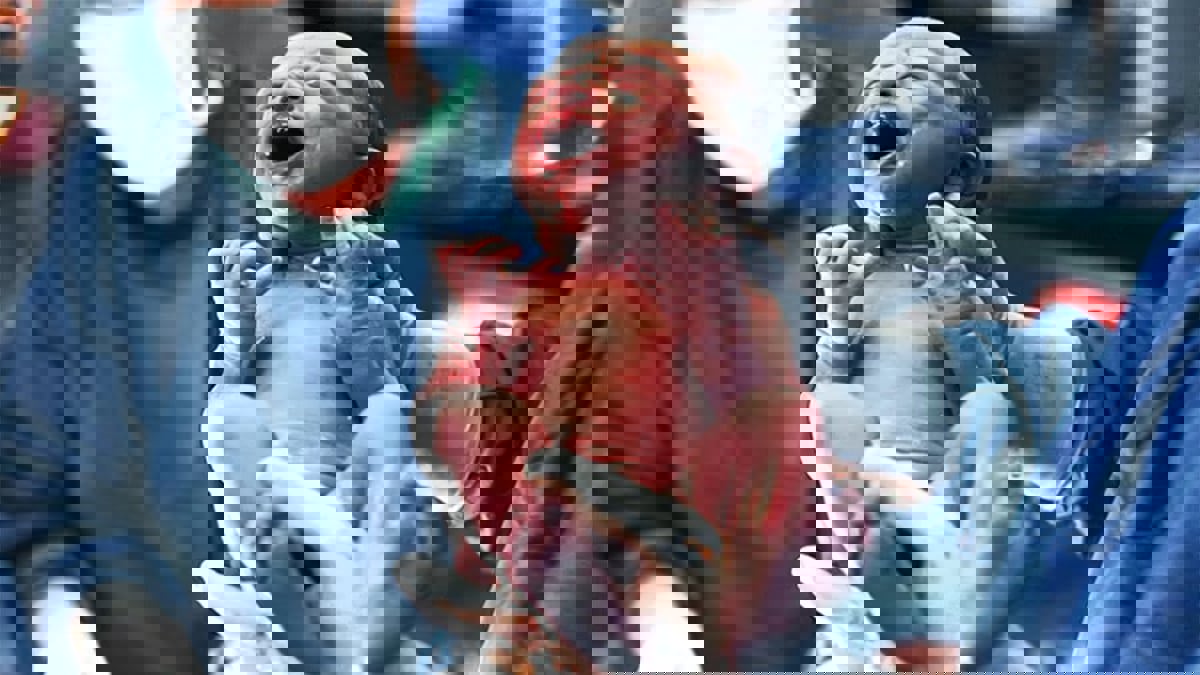 شريط لاصق يحذر الأطباء من إصابة المواليد بالأكزيما مستقبلا