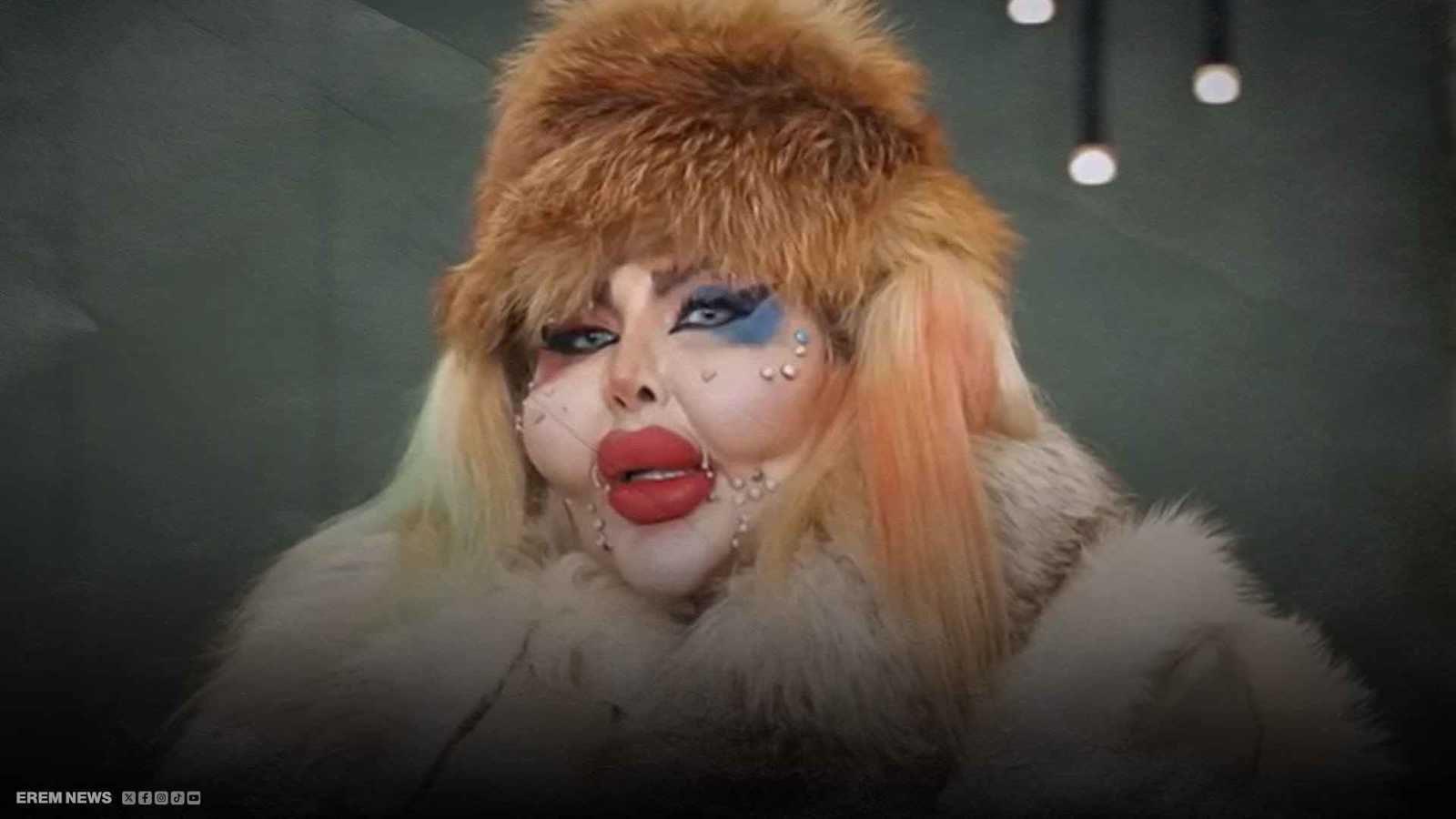 قصة بلوغر لا تُصدق.. 388 عملية تجميل و8 سنوات بلا طعام (فيديو إرم)