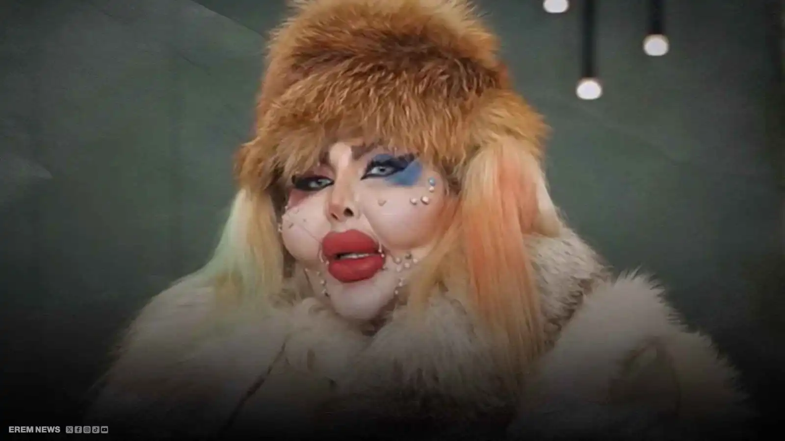 قصة بلوغر لا تُصدق.. 388 عملية تجميل و8 سنوات بلا طعام (فيديو إرم)