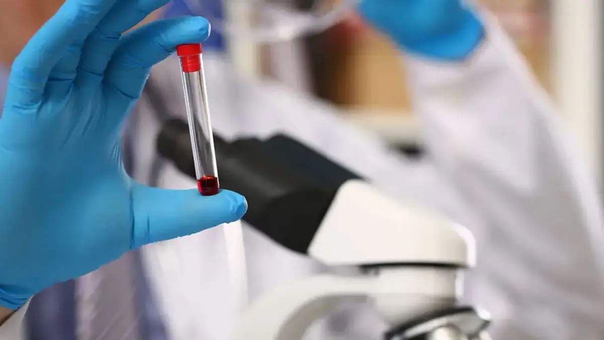 بسعر خيالي.. "الغذاء والدواء" الأمريكية تقر علاجا لـ"الهيموفيليا"