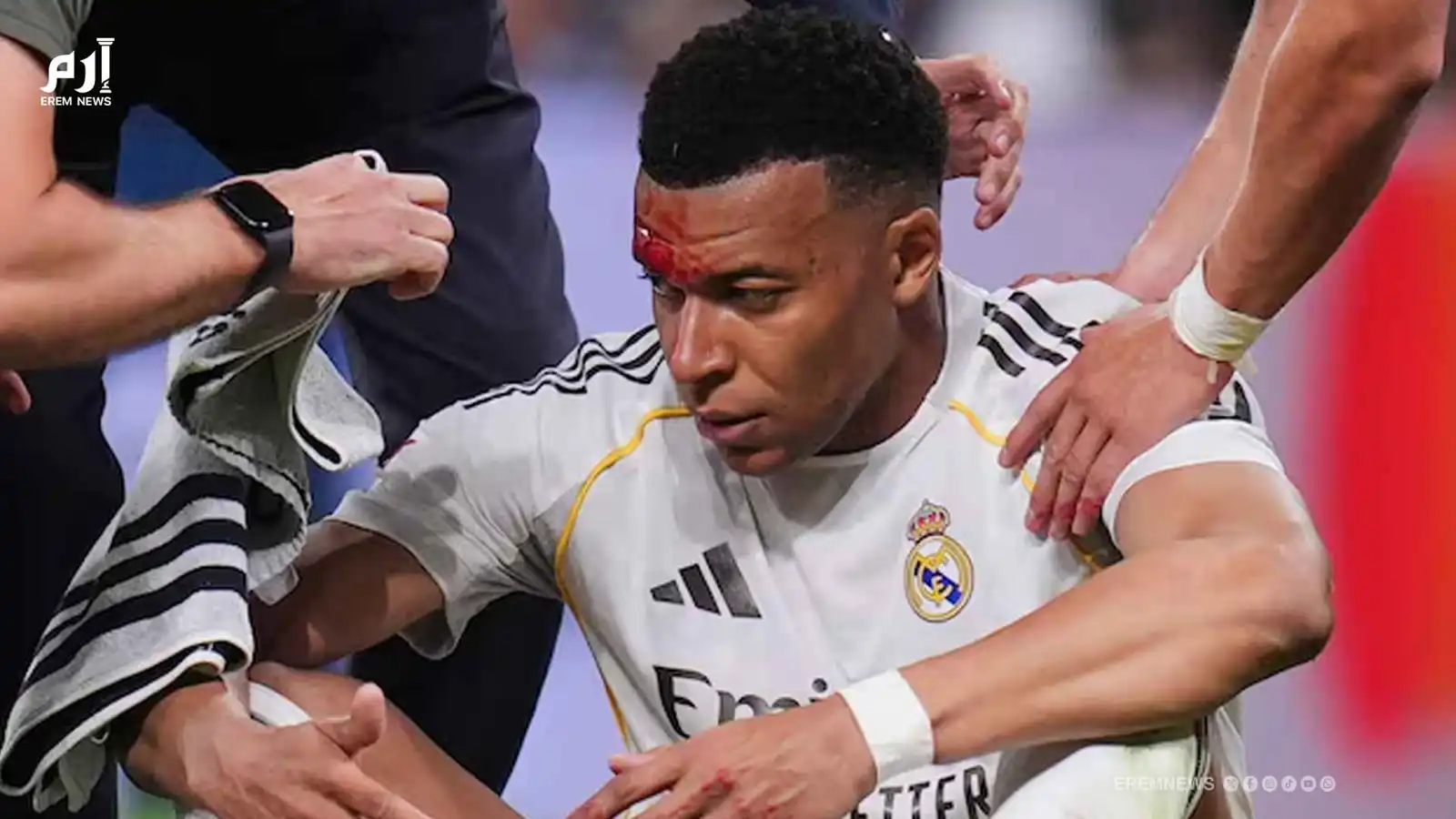 نزيف مبابي يثير الاتهامات ضد التحكيم والبث التلفزيوني.. والليغا ترد