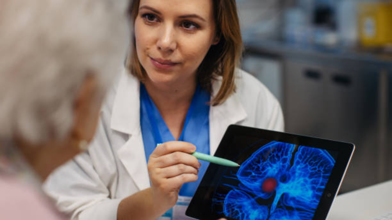 عادات يومية تزيد خطر الإصابة بالسكتة الدماغية