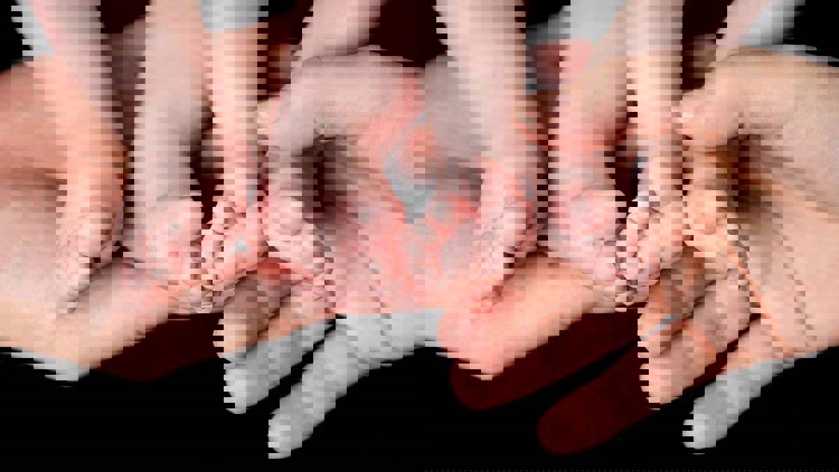 ولادة طفلتين توأمين في عامين مختلفين