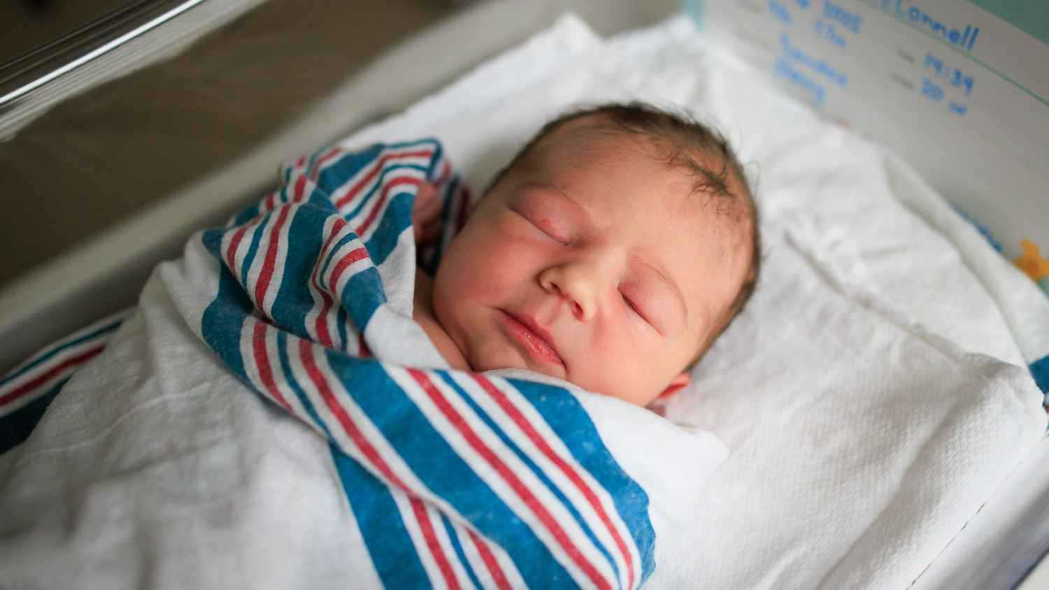 مصر.. ولادة نادرة لطفل مصاب بمتلازمة "الطفل الشمعي" (صور)