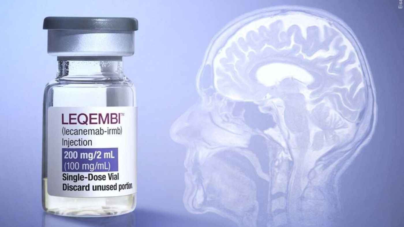 دواء جديد يبعث الأمل لمرضى الزهايمر