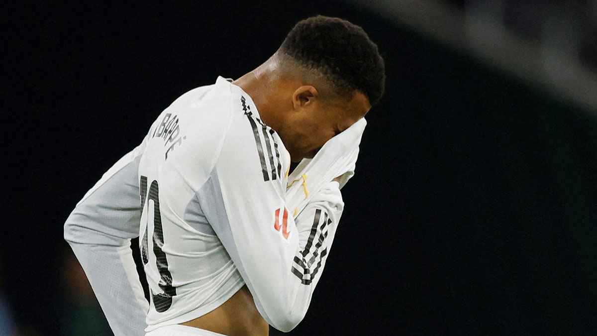 التشخيص المبدئي لإصابة كيليان مبابي 