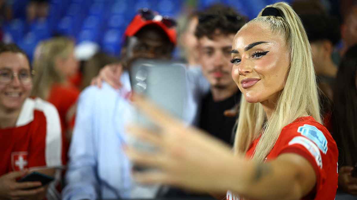 شفتان ممتلئتان.. هل استعدت أليشا ليمان لكأس أوروبا بعمليات التجميل؟ (صور)