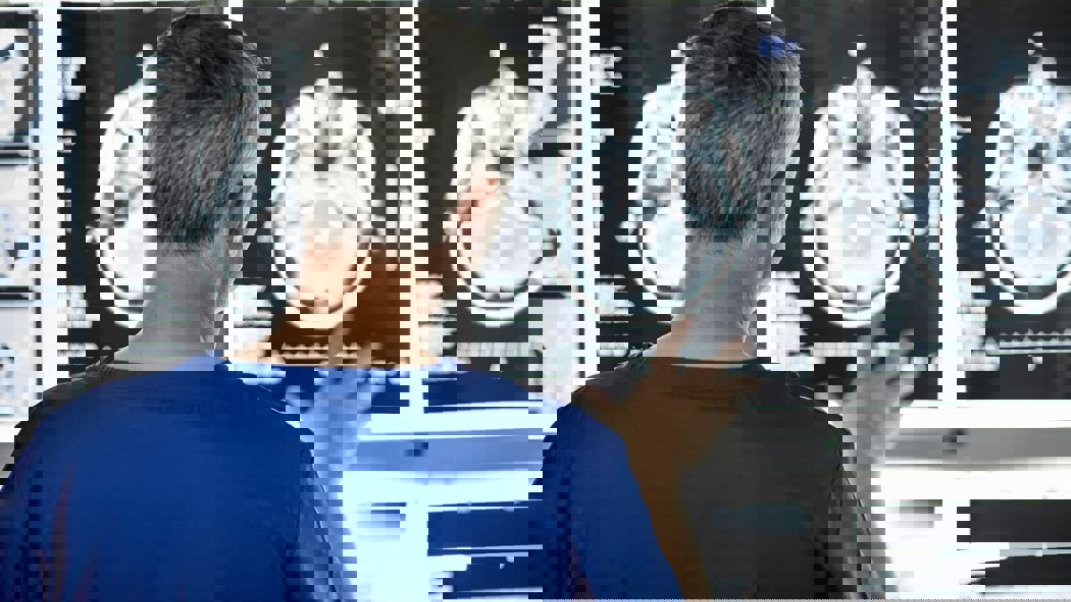 الذكاء الاصطناعي يحلل الكلام للتنبؤ بمرض الزهايمر