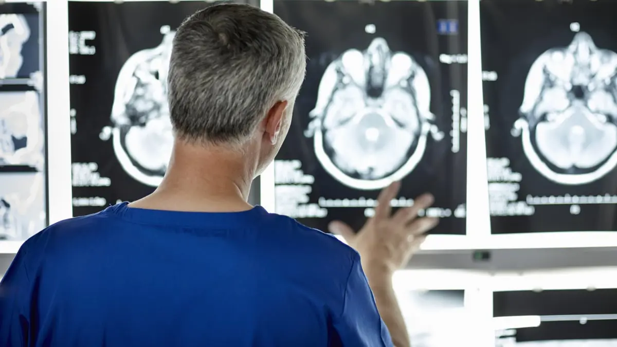 الذكاء الاصطناعي يحلل الكلام للتنبؤ بمرض الزهايمر